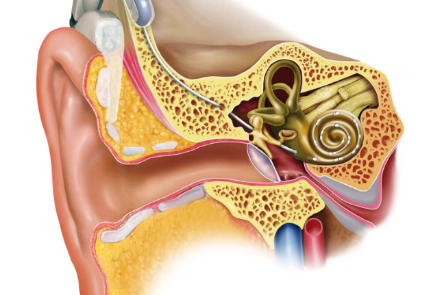 31eb8876fea2d08a0125a008570d4a76.png 人工喉.png