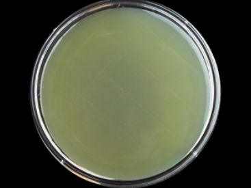 5c9ef624facc137267d5f5e0376c52dc.png 琼脂斜面培养.png